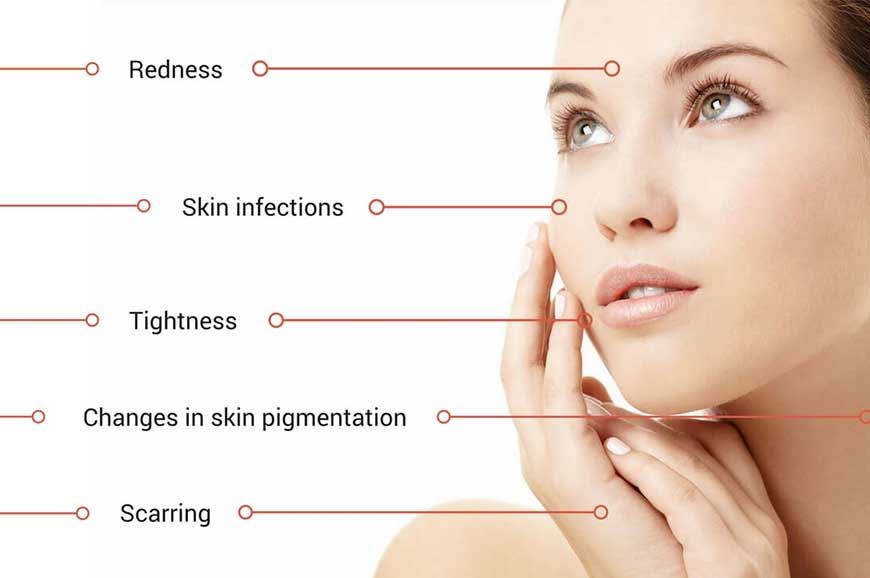 Everything You Need To Know About Skin Whitening