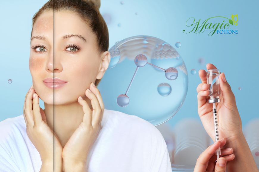 Before and After Skin Whitening Injections: Real Results