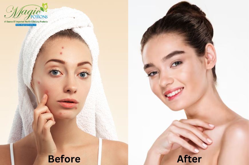 Skin Whitening Injections: The Ultimate Guide to Glutathione