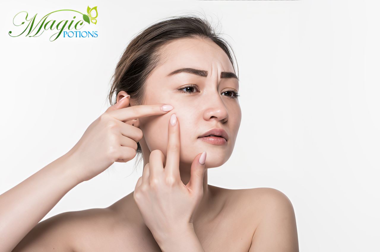 A Week by Week Progress with Vita Glow Night Cream