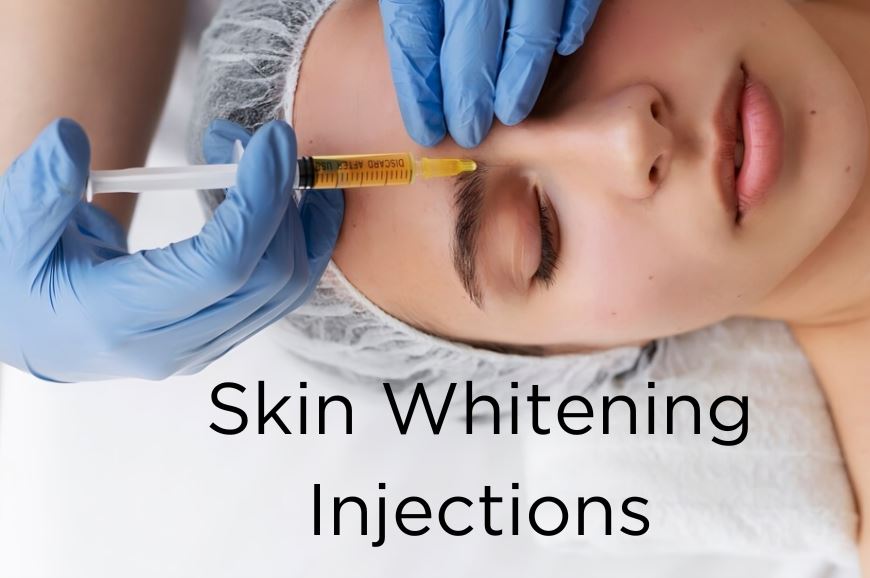 Exploring Skin Whitening Injections for Brighter Complexion